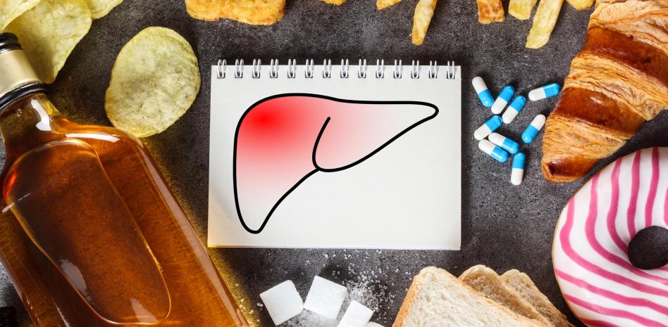 What Is The Best Pill For Fatty Liver: This Is How You Can Clean It