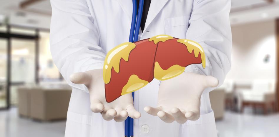 Fatty Liver Is A “Blind” Disease: Why It Keeps Increasing